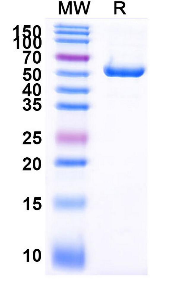 PLAC1 Antibody in SDS-PAGE (SDS-PAGE)