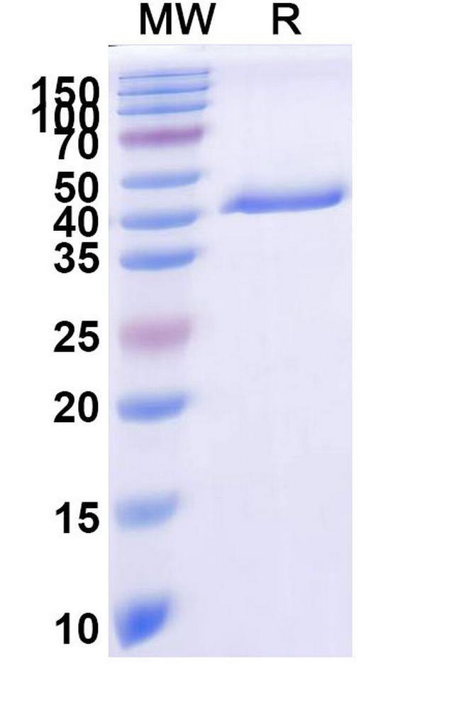 Tau Antibody in SDS-PAGE (SDS-PAGE)