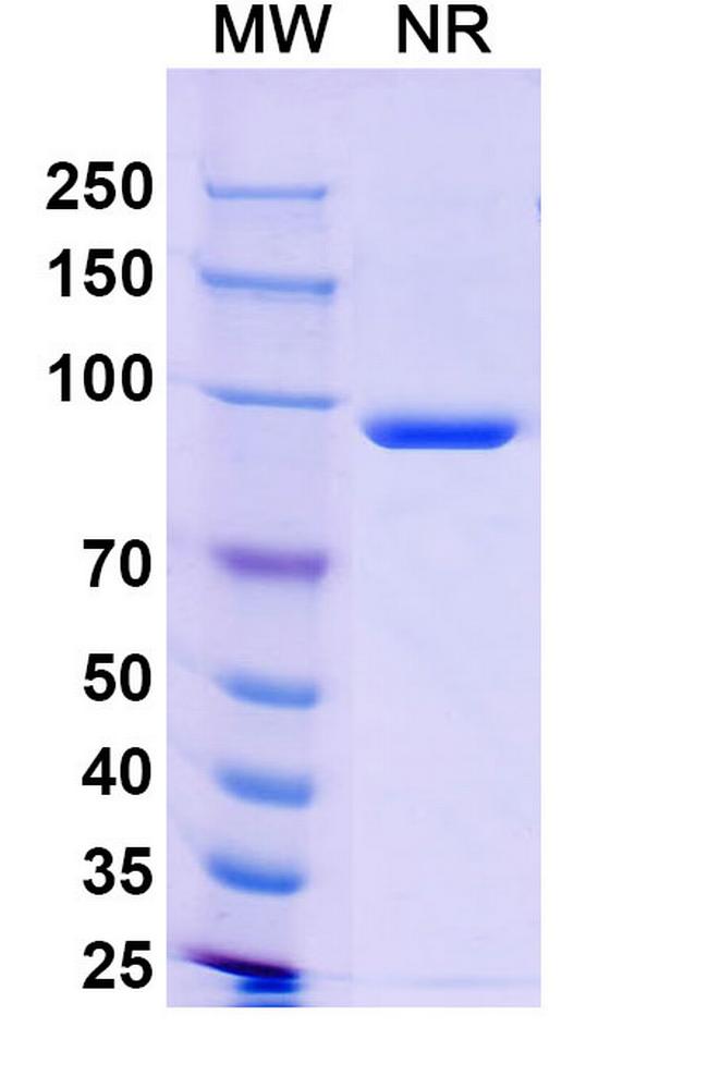 Poliovirus VP1 Antibody in SDS-PAGE (SDS-PAGE)