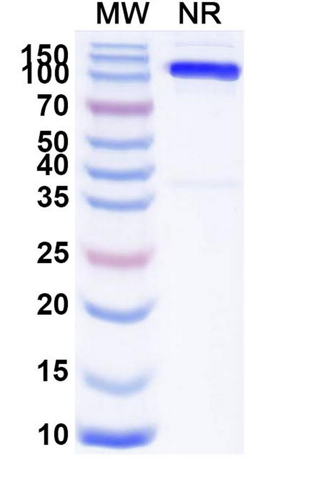 SLC4A7 Antibody in SDS-PAGE (SDS-PAGE)