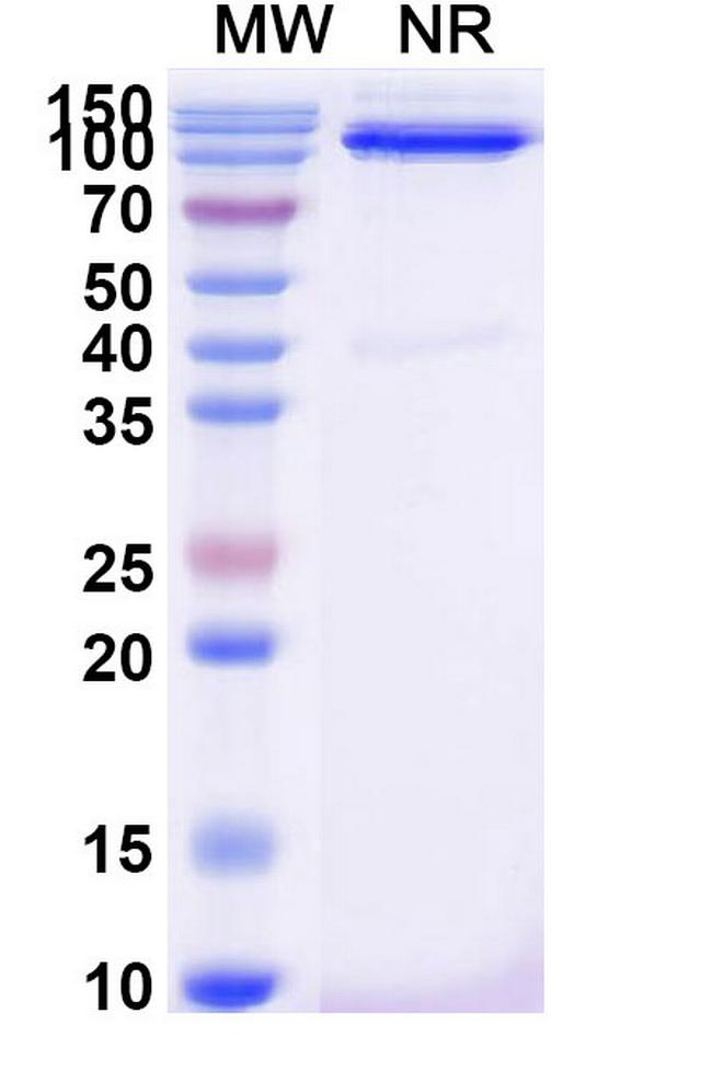 CD31 Antibody in SDS-PAGE (SDS-PAGE)