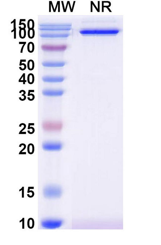 CD31 Antibody in SDS-PAGE (SDS-PAGE)