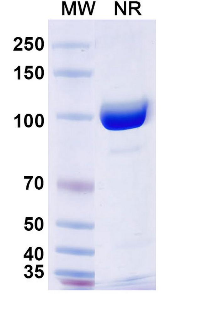 SFTPA1 Antibody in SDS-PAGE (SDS-PAGE)