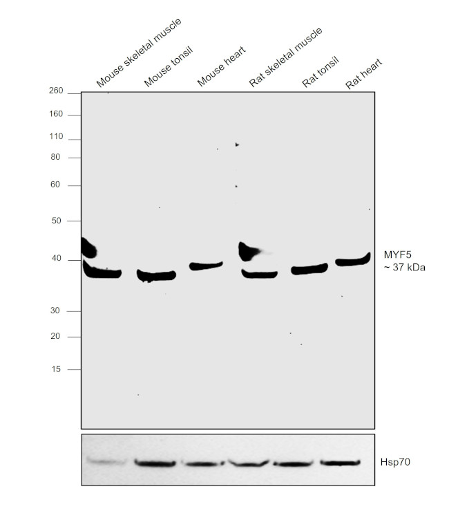 MYF5 Antibody in Western Blot (WB)