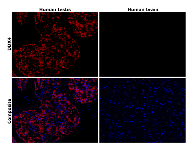 DDX4 Antibody in Immunohistochemistry (Paraffin) (IHC (P))
