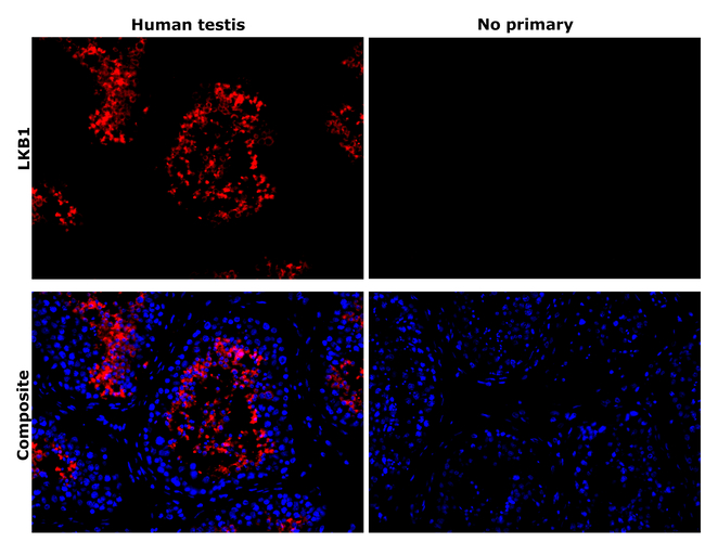 LKB1 Antibody in Immunohistochemistry (Paraffin) (IHC (P))