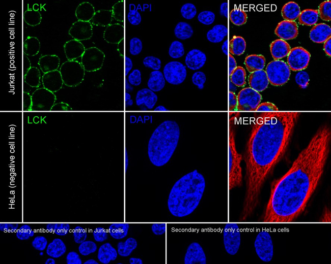 LCK Antibody in Immunocytochemistry (ICC/IF)