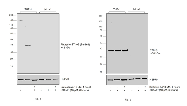 Phospho-STING (Ser366) Antibody in Western Blot (WB)