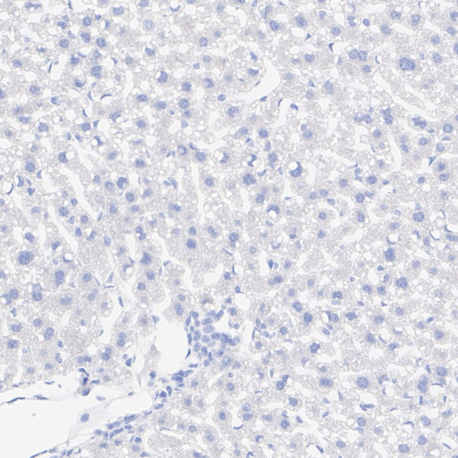 DNAJC6 Antibody in Immunohistochemistry (Paraffin) (IHC (P))
