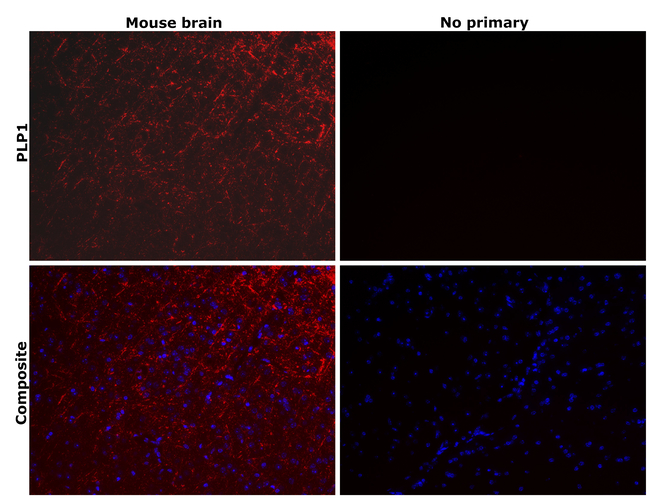 Myelin PLP Antibody in Immunohistochemistry (Paraffin) (IHC (P))