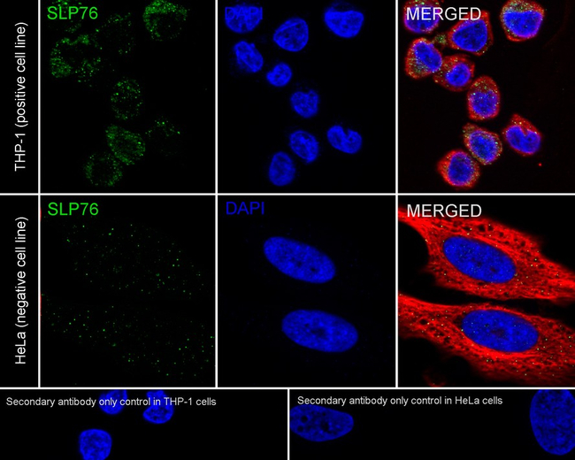 SLP76 Antibody in Immunocytochemistry (ICC/IF)