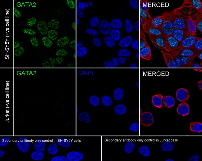 GATA2 Antibody in Immunocytochemistry (ICC/IF)