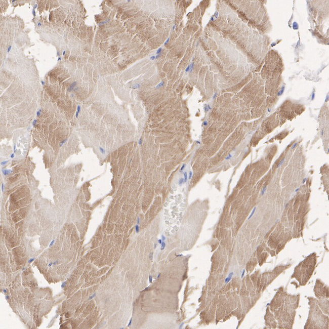 AS160 Antibody in Immunohistochemistry (Paraffin) (IHC (P))