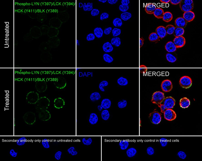 Phospho-LYN/LCK/HCK/BLK (Tyr397, Tyr394, Tyr411, Tyr389) Antibody in Immunocytochemistry (ICC/IF)