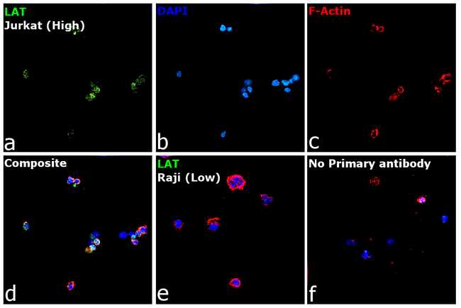 LAT Antibody in Immunocytochemistry (ICC/IF)