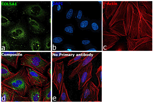 COL5A1 Antibody in Immunocytochemistry (ICC/IF)