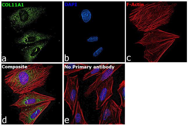 COL11A1 Antibody in Immunocytochemistry (ICC/IF)