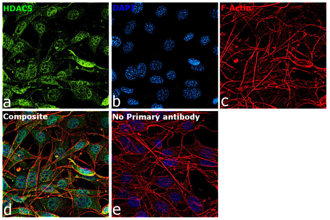 HDAC5 Antibody in Immunocytochemistry (ICC/IF)