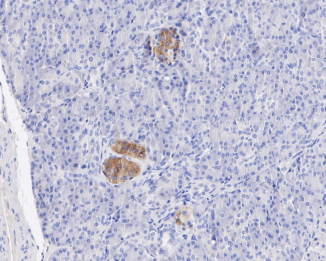 DLK1 Antibody in Immunohistochemistry (Paraffin) (IHC (P))