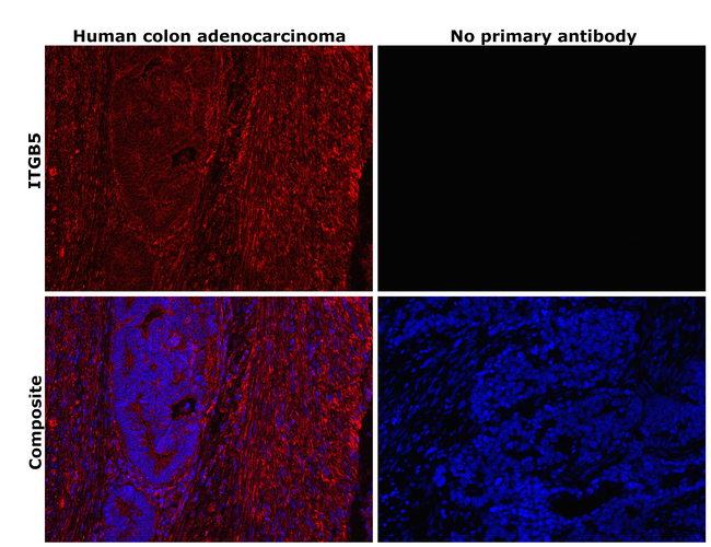 ITGB5 Antibody in Immunohistochemistry (Paraffin) (IHC (P))