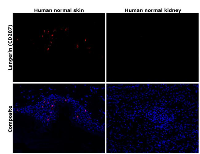 Langerin Antibody in Immunohistochemistry (Paraffin) (IHC (P))