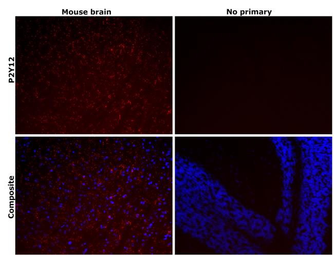 P2Y12 Antibody in Immunohistochemistry (Paraffin) (IHC (P))