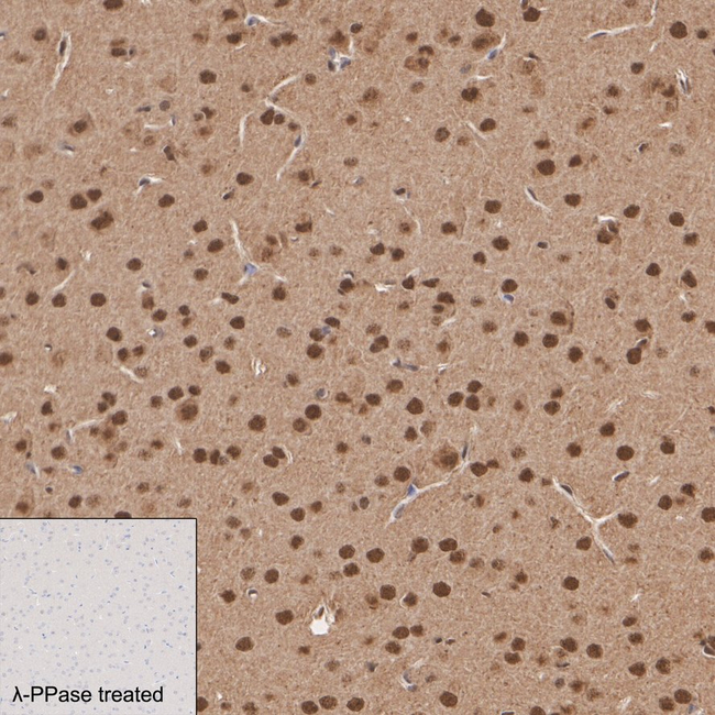 Phospho-AMPK alpha-1,2 (Thr183, Thr172) Antibody in Immunohistochemistry (Paraffin) (IHC (P))