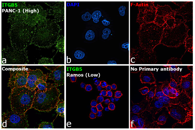 ITGB5 Antibody in Immunocytochemistry (ICC/IF)
