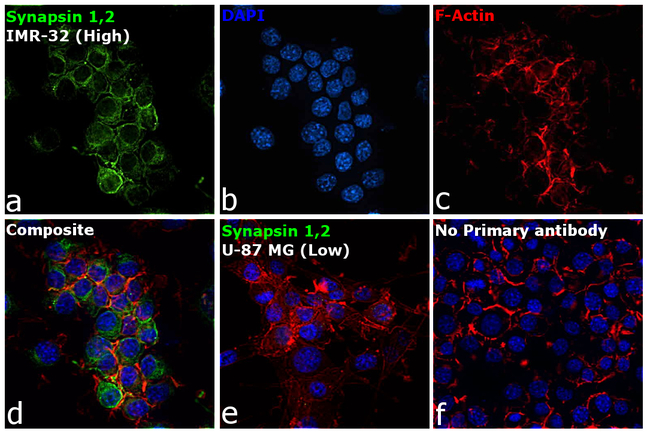 Synapsin 1/2 Antibody in Immunocytochemistry (ICC/IF)