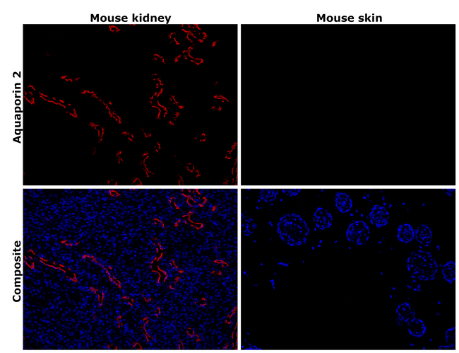 Aquaporin 2 Antibody in Immunohistochemistry (Paraffin) (IHC (P))
