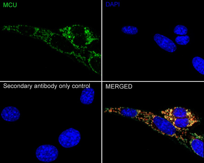 MCU Antibody in Immunocytochemistry (ICC/IF)