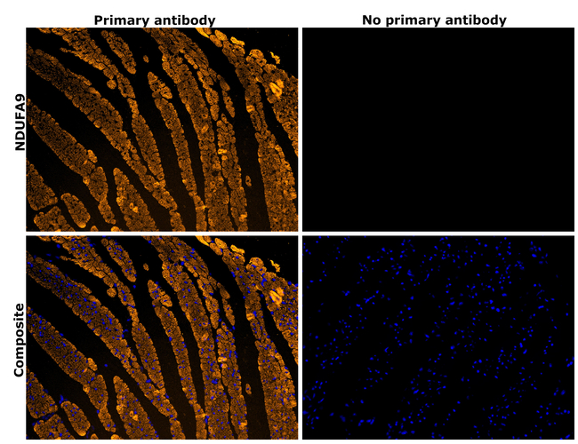 NDUFA9 Antibody in Immunohistochemistry (Paraffin) (IHC (P))