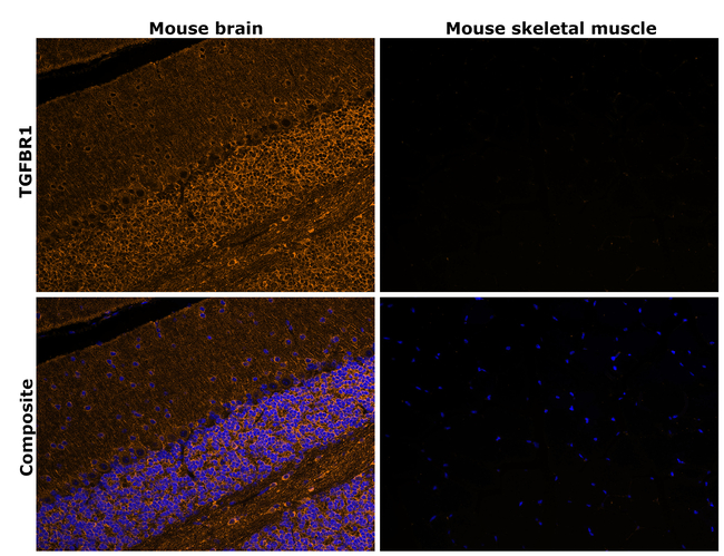 TGFBR1 Antibody in Immunohistochemistry (Paraffin) (IHC (P))