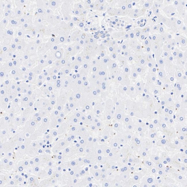 RAB27B Antibody in Immunohistochemistry (Paraffin) (IHC (P))