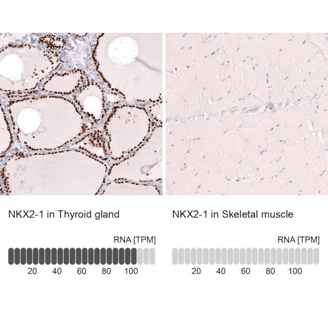 Nkx2.1 Antibody in Immunohistochemistry (Paraffin) (IHC (P))
