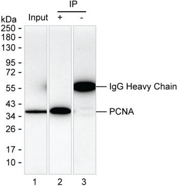 PCNA Antibody in Immunoprecipitation (IP)