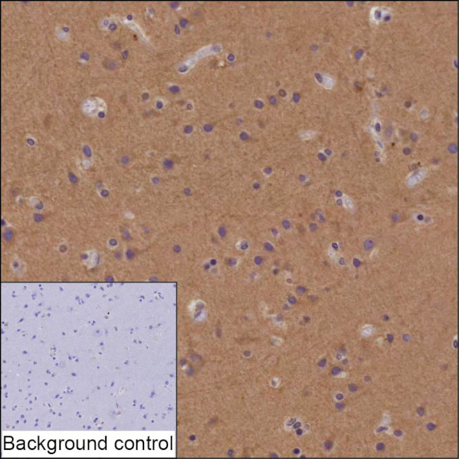Bassoon Antibody in Immunohistochemistry (Paraffin) (IHC (P))