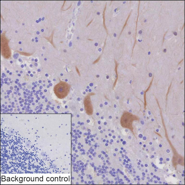 PSD93 Antibody in Immunohistochemistry (Paraffin) (IHC (P))