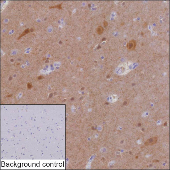 HOMER1 Antibody in Immunohistochemistry (Paraffin) (IHC (P))