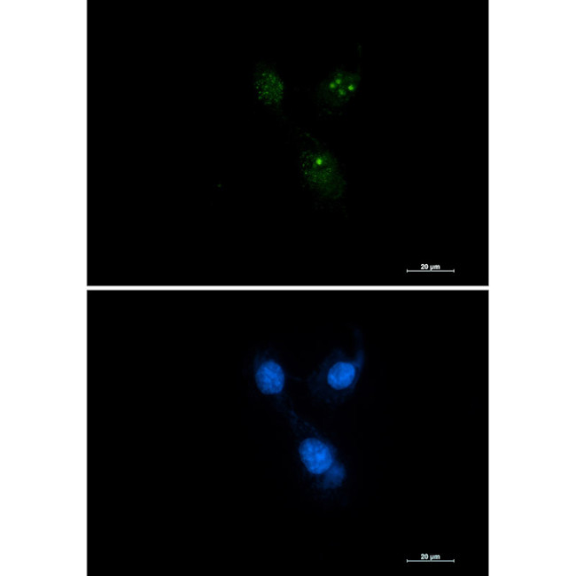 Presenilin 1 Antibody in Immunocytochemistry (ICC/IF)