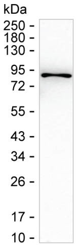 BDKRB2 Antibody in Western Blot (WB)