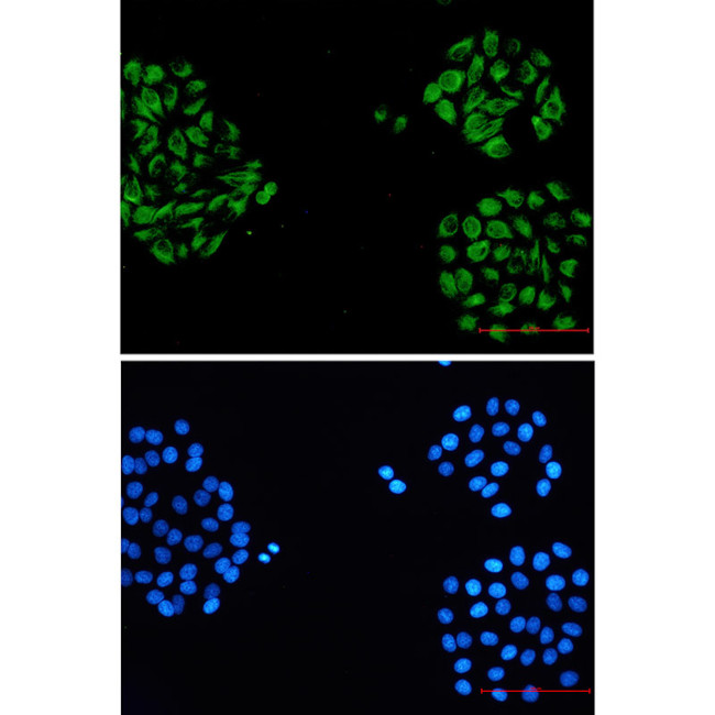 alpha Internexin Antibody in Immunocytochemistry (ICC/IF)