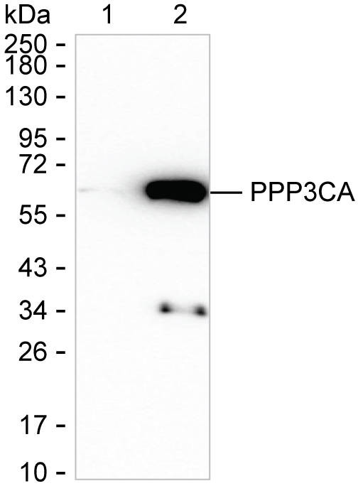 Calcineurin A Antibody in Western Blot (WB)