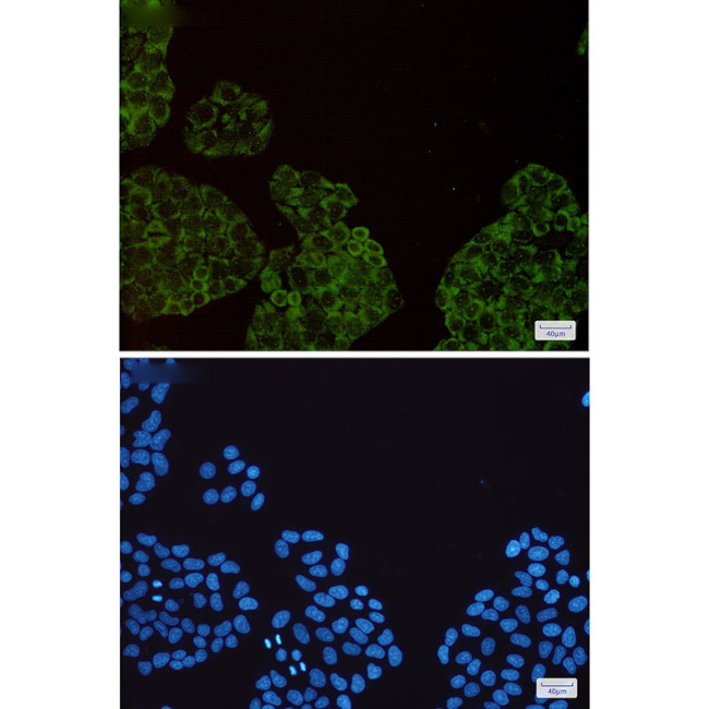 SMN1 Antibody in Immunocytochemistry (ICC/IF)