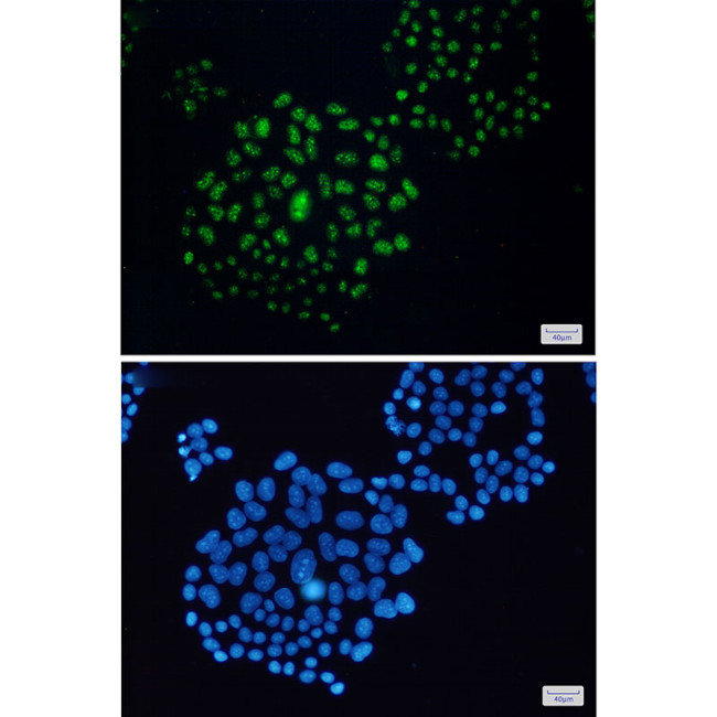 EWSR1 Antibody in Immunocytochemistry (ICC/IF)