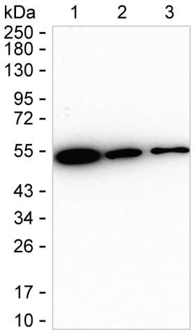 TACR1 Antibody in Western Blot (WB)