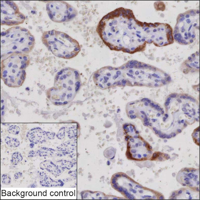 hCG beta-2 Antibody in Immunohistochemistry (Paraffin) (IHC (P))
