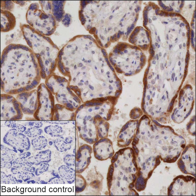 hCG beta-1 Antibody in Immunohistochemistry (Paraffin) (IHC (P))