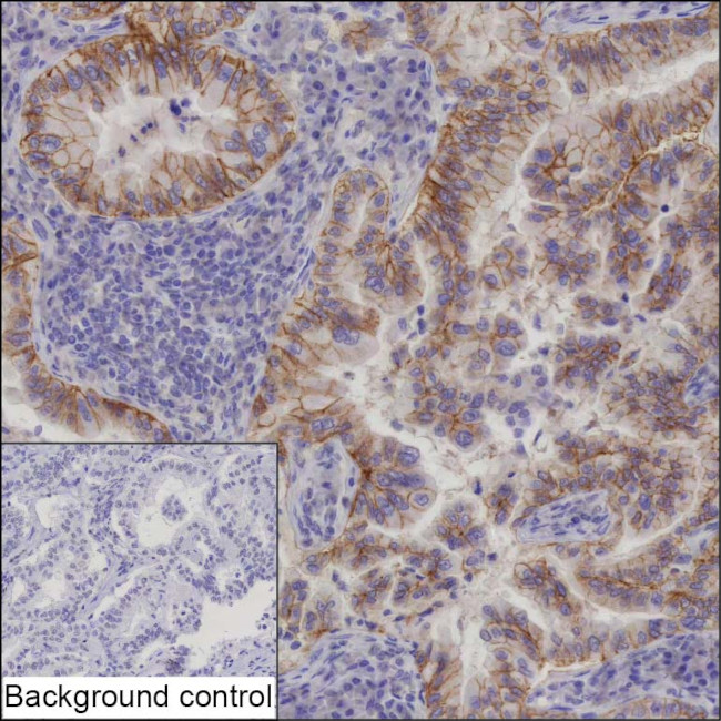 ErbB2 (HER-2) Antibody in Immunohistochemistry (Paraffin) (IHC (P))
