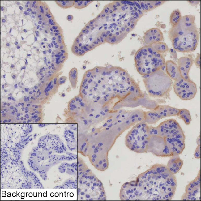 CSF3R Antibody in Immunohistochemistry (Paraffin) (IHC (P))